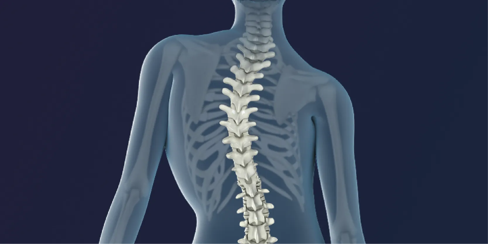 Escoliosis Y Quiropráctica